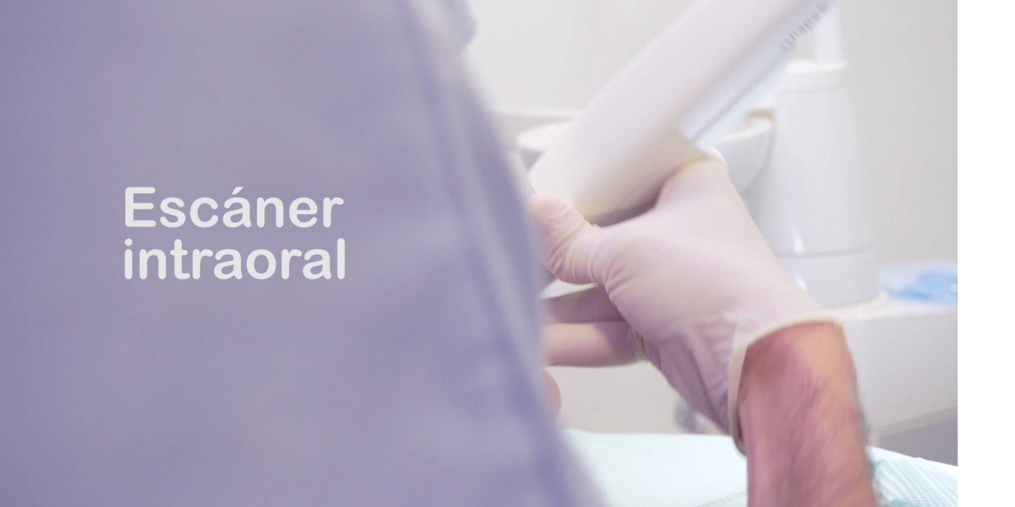 escaner intraoral