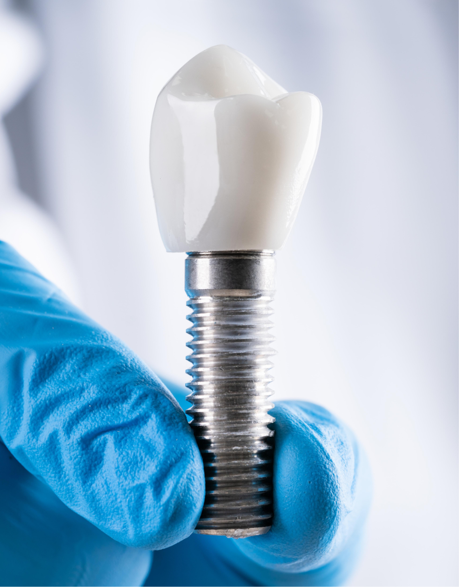 En nuestra clinica dental Castellón