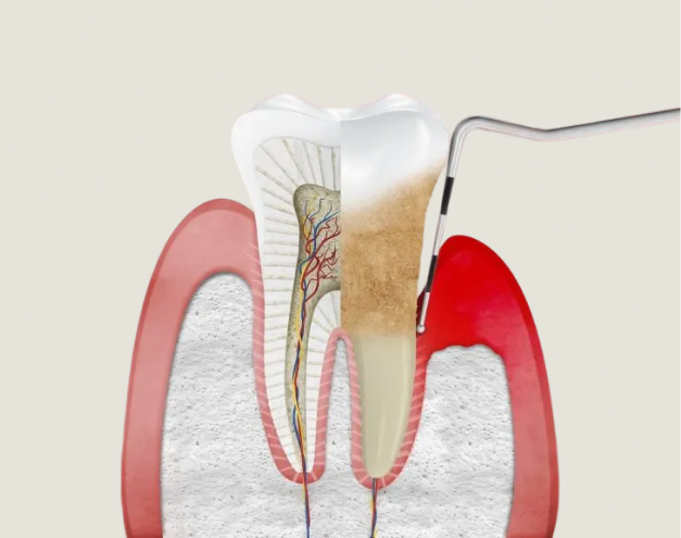 Que es la Periodoncia